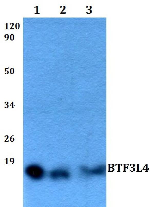 a15784 1 btf3l4 primary antiboties wb testing 1