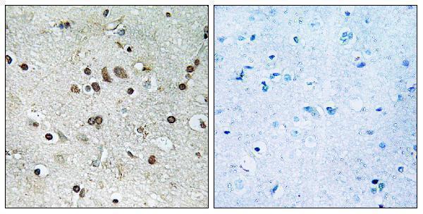 a15784 btf3l4 primary antibodies ihc testing 1