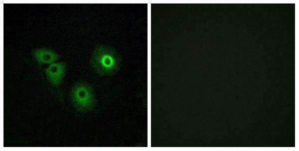 a15816 or4a15 primary antibodies if testing 1