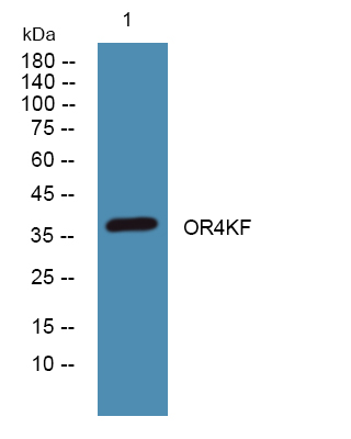 Western blot analysis of lysates from PC12 cells, primary antibody was diluted at 1:1000, 4°over night
