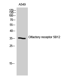 Western Blot analysis of A549 cells using Olfactory receptor 5B12 Polyclonal Antibody