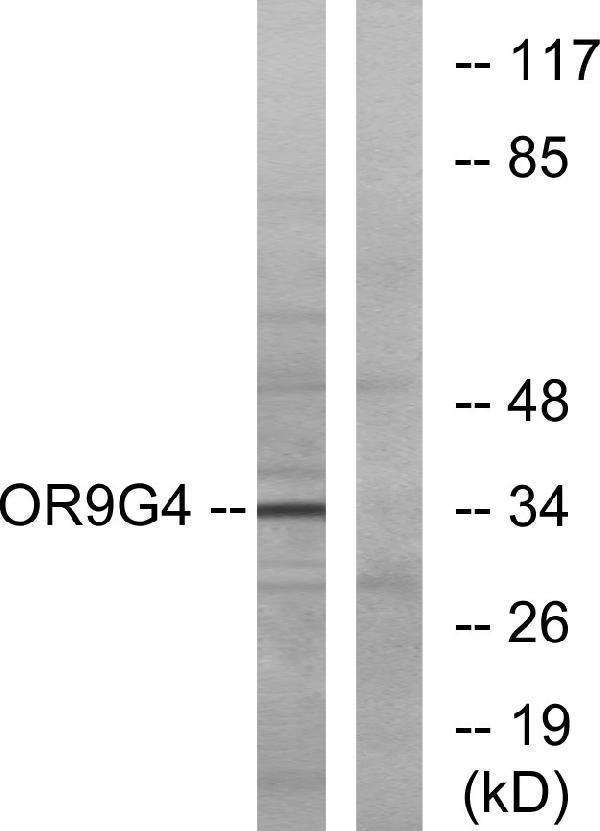 Western blot analysis of lysates from HeLa cells, using OR9G4 Antibody