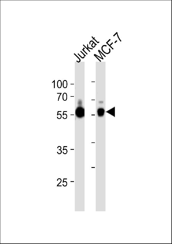 ZNF434 Antibody (Center) (Cat. #A15854) western blot analysis in Jurkat,MCF-7 cell line lysates (35ug/lane). This demonstrates the ZNF434 antibody detected the ZNF434 protein (arrow).
