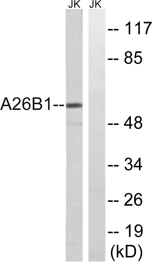 Western blot analysis of lysates from Jurkat cells, using A26B1 Antibody