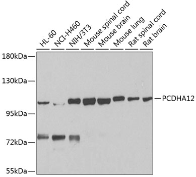 a15869 pcdha12 primary antiboties wb testing 1