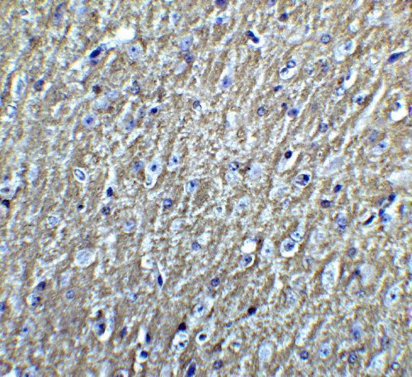 a15882 1 dclk3 primary antibodies ihc testing 3