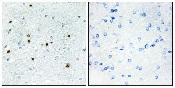 a15882 dclk3 primary antibodies ihc testing 1