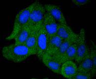 ICC staining AKAP14 in Hela cells (green)