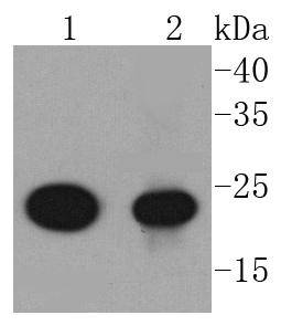 Western blot analysis of AKAP14 on different lysates using anti-AKAP14 antibody at 1/1,000 dilution