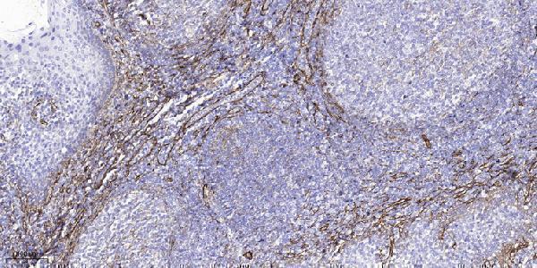 a15886 akap14 primary antibodies ihc testing 5
