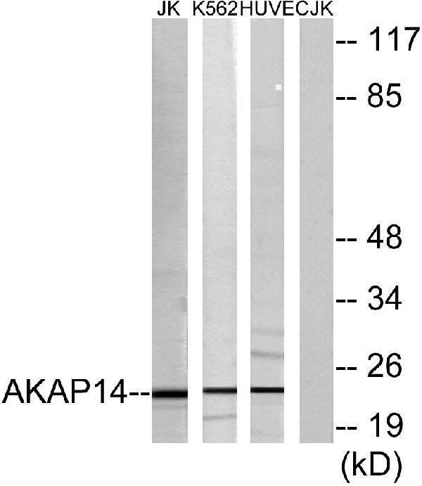 Western blot analysis of lysates from Jurkat, K562, and HUVEC cells, using AKAP14 Antibody
