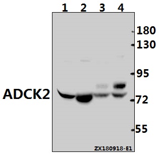 a15887y256 adck2 primary antiboties wb testing 1