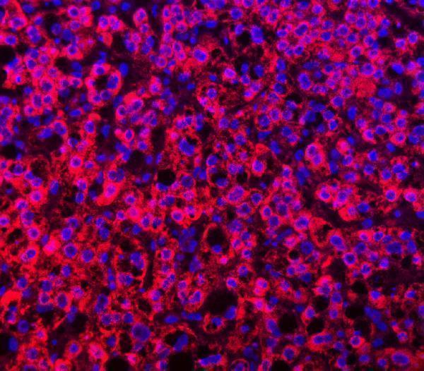 a15891 ttll2 primary antibodies if testing 12