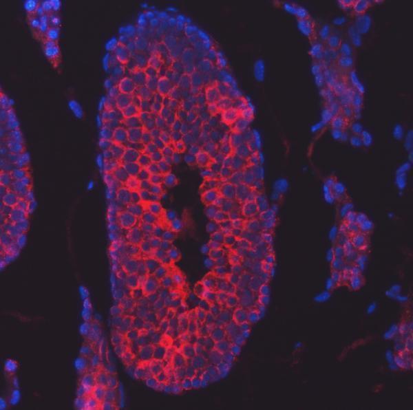 a15891 ttll2 primary antibodies if testing 13