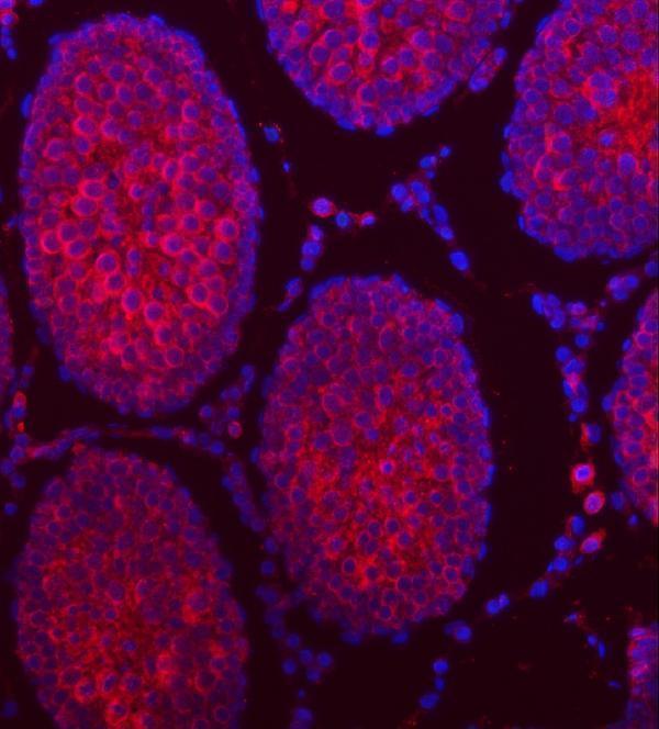 a15891 ttll2 primary antibodies if testing 14