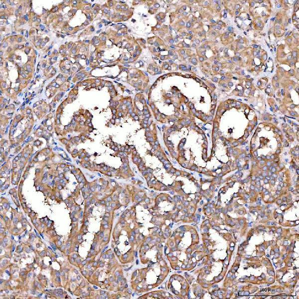 a15891 ttll2 primary antibodies ihc testing 11