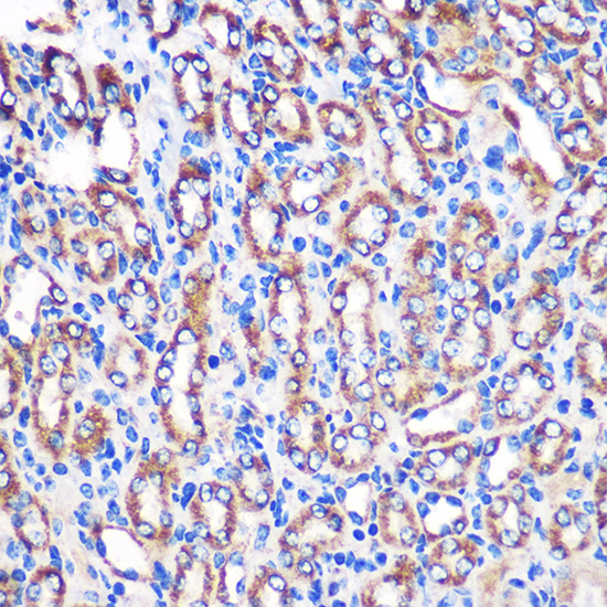 Immunohistochemistry of paraffin-embedded Mouse kidney using NDUFA4L2 Rabbit pAb  at dilution of 1:100 