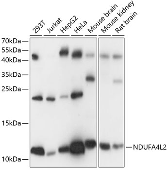 Western blot analysis of extracts of various cell lines, using NDUFA4L2 antibody  at 1:1000 dilution