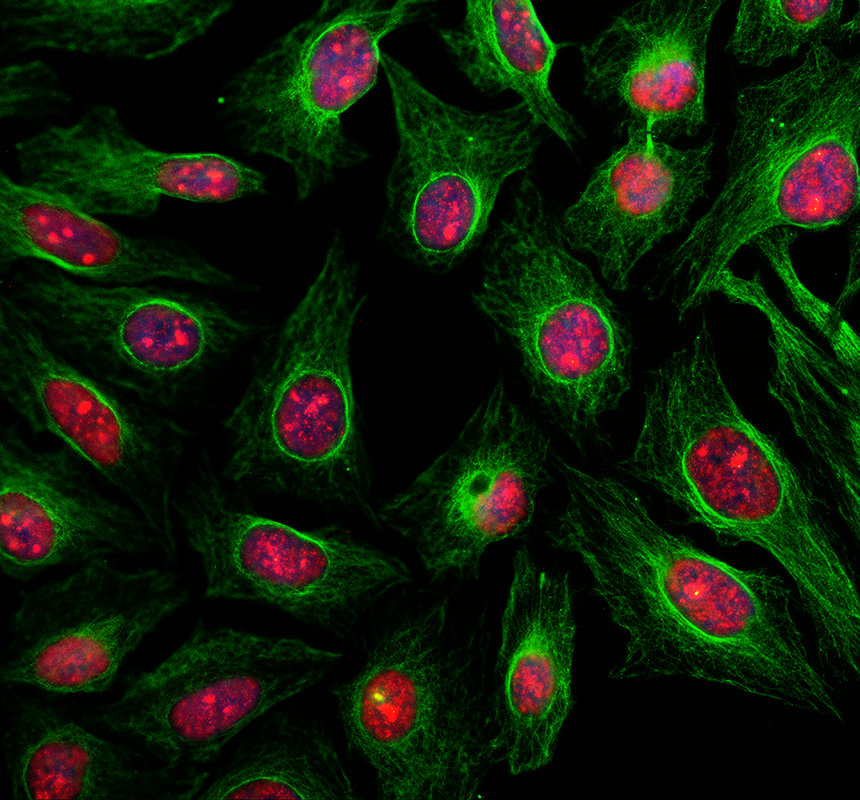 IF analysis of MORN1 using anti-MORN1 antibody (A15917-1) and anti-Alpha Tubulin antibody (M03989-3)