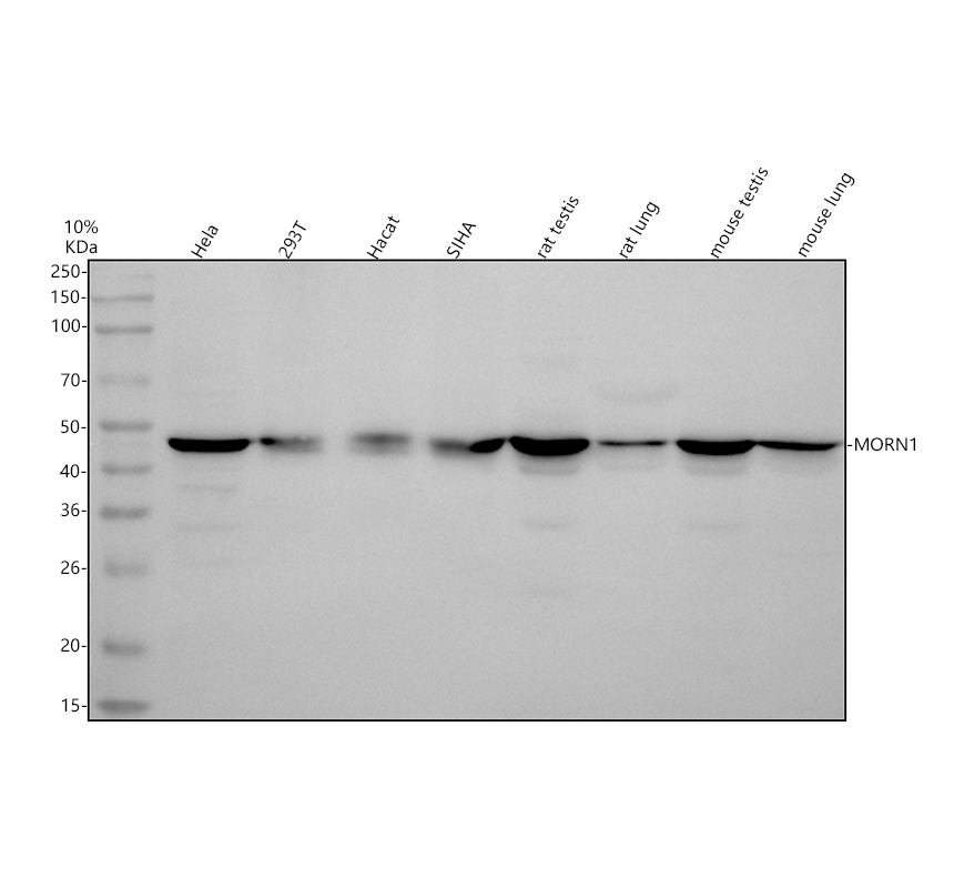 Western blot analysis of MORN1 using anti-MORN1 antibody (A15917-1)