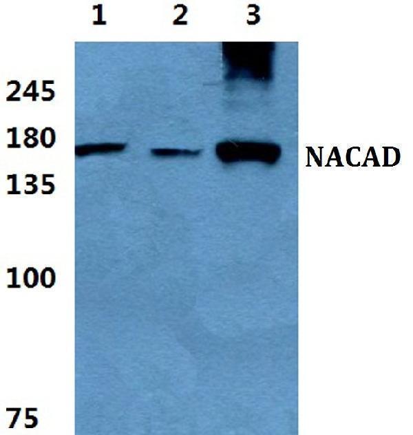 Western blot (WB) analysis of NACAD polyclonal antibody at 1:500 dilution
Lane1:MCF-7 cell lysate
Lane2:sp2/0 cell lysate
Lane3:H9C2 cell lysate