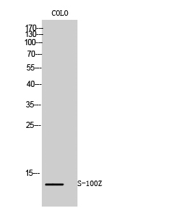 Western blotting validation for Anti-S-100Z Antibody A15948-1
Western Blot (WB) analysis of COLO205 cells using S-100Z polyclonal antibody