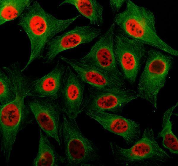 a15949 3 foxi2 primary antibodies if testing 1