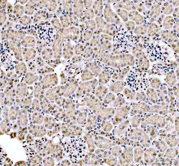 a15949 3 foxi2 primary antibodies ihc testing 3