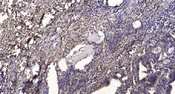 a15959 grtp1 primary antibodies ihc testing 1