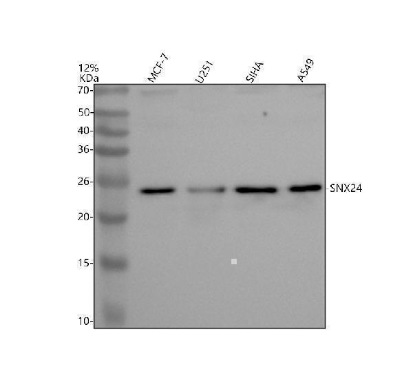Western blot analysis of SNX24 using anti-SNX24 antibody (A15961-1)