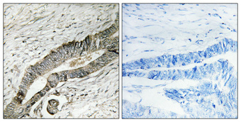 Immunohistochemistry validation of MOB3B using Anti-MOB kinase activator 3B Mob3B Antibody (A15976-1)