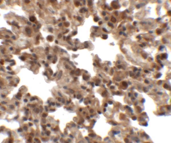 Immunohistochemistry of FXYD7 in rat lung tissue with FXYD7 antibody at 2