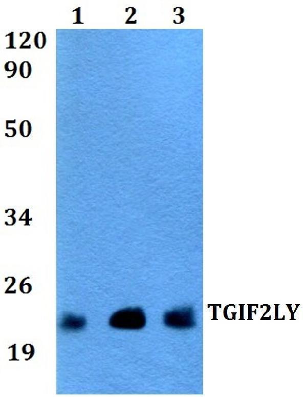 a15992 tgif2ly primary antiboties wb testing 1