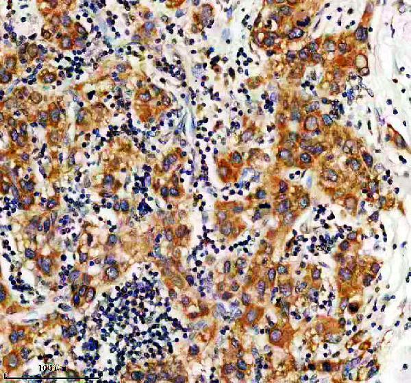 a16001 dnajc4 primary antibodies ihc testing 1
