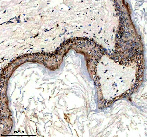 a16019 sprr4 primary antibodies ihc testing 1