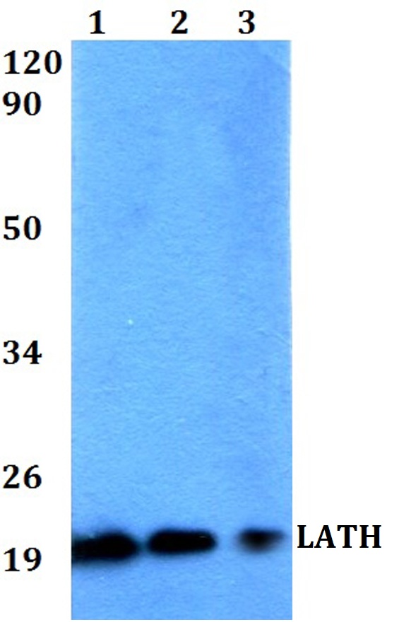 Western blot (WB) analysis of LATH polyclonal antibody at 1:500 dilution
Lane1:HEK293T whole cell lysate
Lane2:Raw264