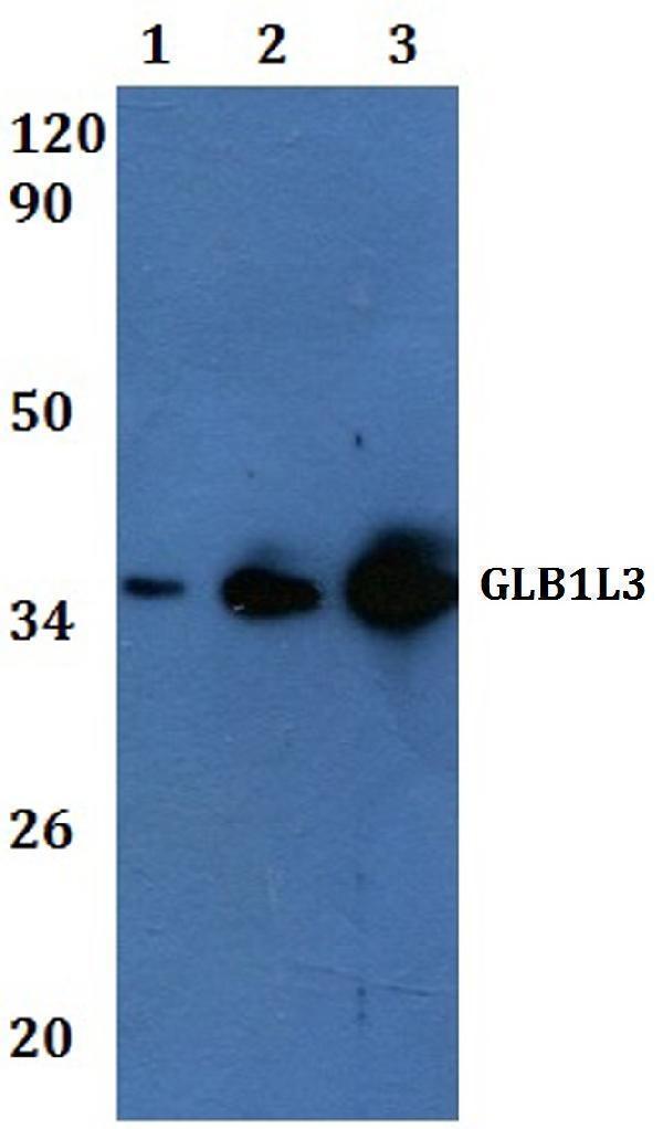 Western blot (WB) analysis of GLB1L3 polyclonal antibody at 1:500
Line1:Hela whole cell lysate
Line2:THP-1 whole cell lysate
Line3:H9C2 whole cell lysate
Line4:sp20 whole cell lysate