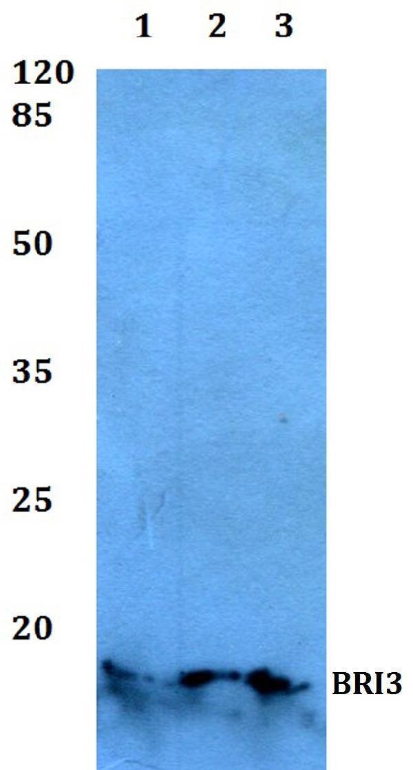 Western blot (WB) analysis of BRI3 polyclonal antibody at 1:500 dilution
Lane1:Hela whole cell lysate
Lane2:Mouse brain tissue lysate
Lane3:Rat colon tissue lysate
