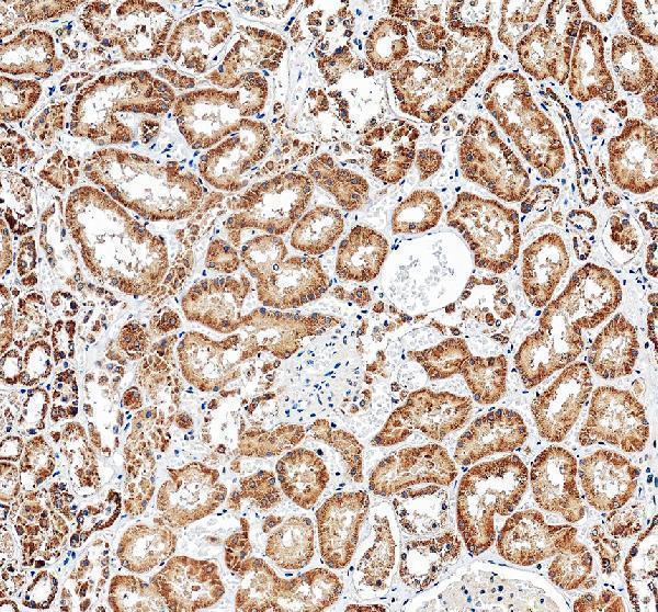 IHC analysis of GDPD3 using anti-GDPD3 antibody (A16040-1)