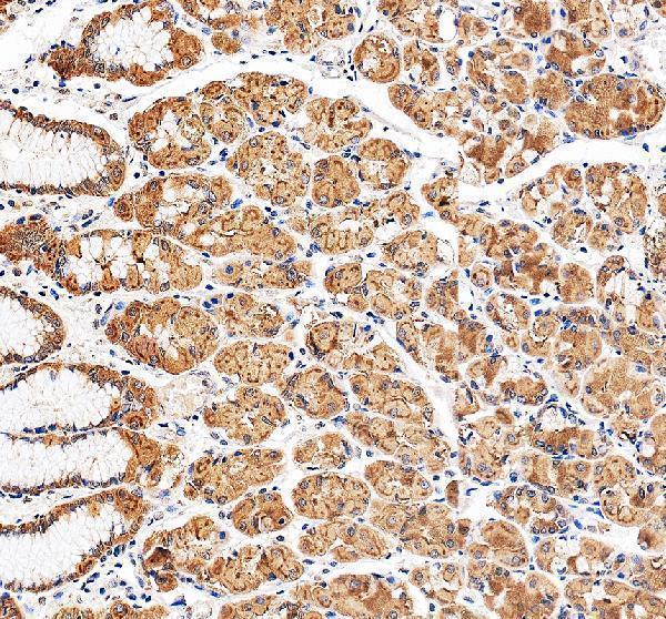 IHC analysis of GDPD3 using anti-GDPD3 antibody (A16040-1)