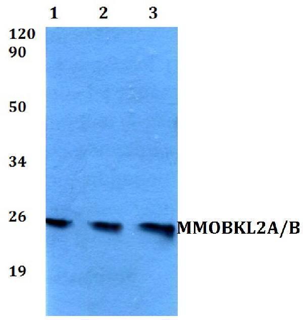 Western blot (WB) analysis of MMOBKL2A/B polyclonal antibody at 1:500 dilution
Lane1:HEK293T whole cell lysate
Lane2:sp2/0 whole cell lysate 
Lane3:PC12 whole cell lysate 