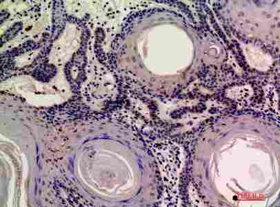Immunohistochemistry (IHC) analysis of paraffin-embedded Human Skin, antibody was diluted at 1:200