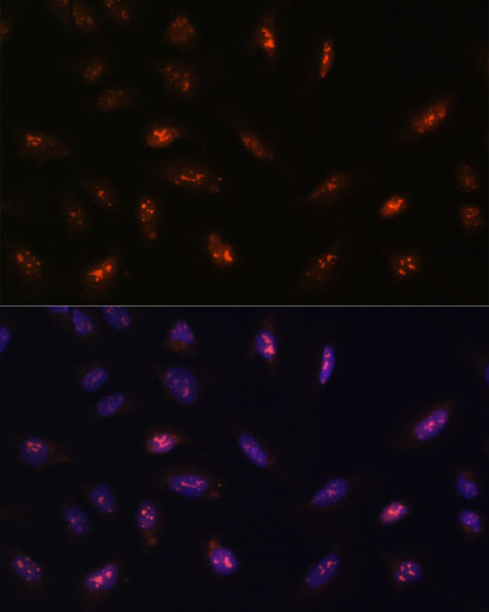 a16117 llph primary antiboties if testing 2