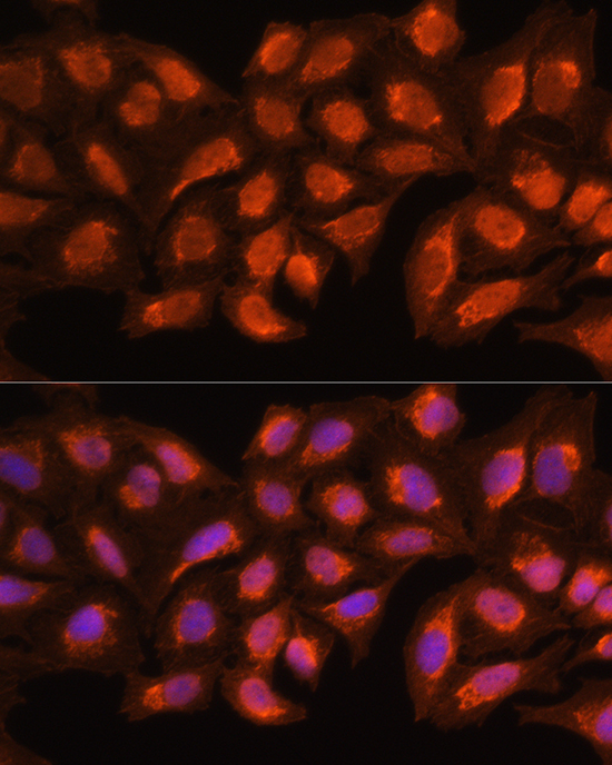 a16141 mrpl45 primary antiboties if testing 3