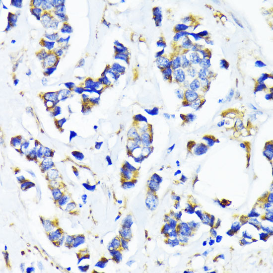 a16141 mrpl45 primary antiboties ihc testing 2