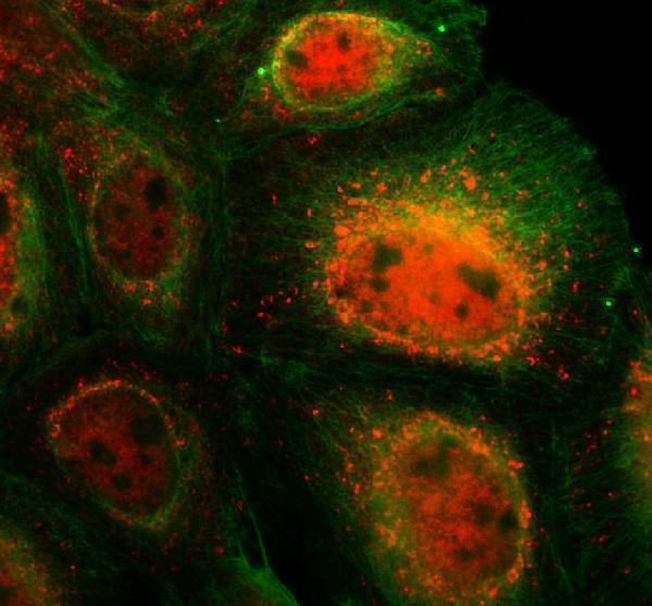 a16153 1 frmd8 primary antibodies if testing 1