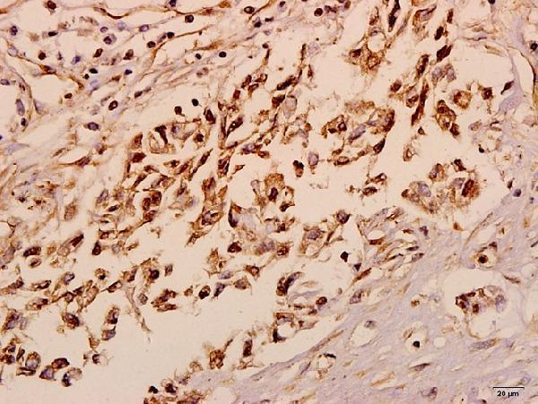 a16162 1 nxph4 primary antiboties ihc testing 2