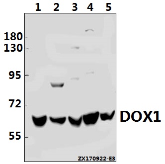 Western blot (WB) analysis of DQX1 (L595) pAb at 1:500 dilution
Lane1:HepG2 whole cell lysate(40ug)
Lane2:HCT116 whole cell lysate(40ug)
Lane3:SGC7901 whole cell lysate(40ug)
Lane4:CT26 whole cell lysate(40ug)
Lane5:H9C2 whole cell lysate(40ug)