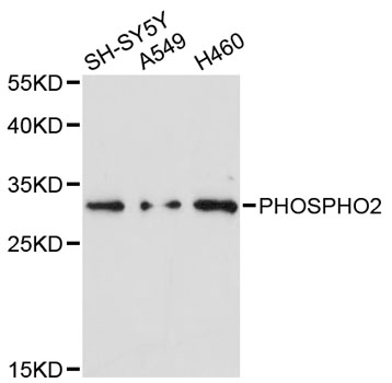 Western blot analysis of extracts of various cell lines, using PHOSPHO2 antibody at 1:3000 dilution
