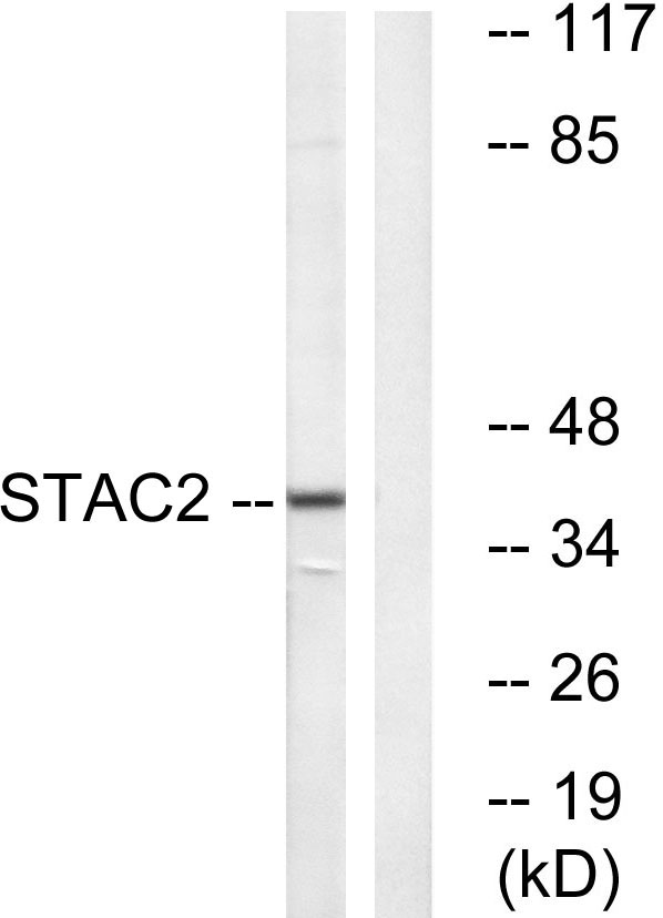 a16187 1 stac2 primary antibodies wb testing 1